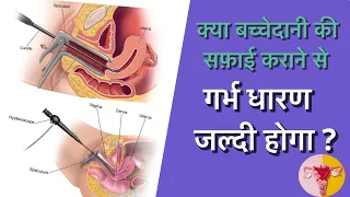 क्या बच्चेदानी की सफ़ाई कराने से  गर्भ धारण जल्दी होता है ? |Dr Poonam Maggo