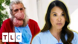 Dr. Lee Treats "The Biggest, Most Extravagant Case Of Rynophyma" She's Ever Seen | Dr. Pimple Popper