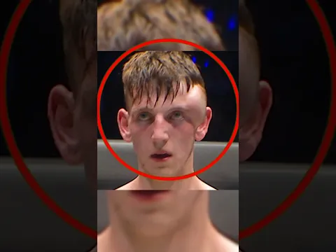 This Fighter's Head Swelled Like a Balloon! 😱