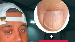بوضاري خطوط بالاظافر