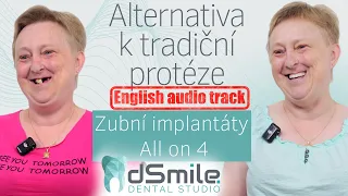 All-on-4: Náhrada zubů ve 45 letech – Konec s protézou!#implant#dentist #dsmile#allon4dentalimplants