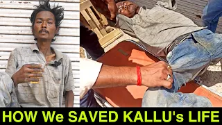 कल्लू  जैसे हज़ारों लोग रोज़ अपनी ज़िंदगी खो देते है #helpthem