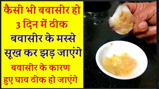 bawasir ka gharelu elaj in hindi, बवासीर कैसे ठीक करें  bawasir ke liye deshi nuskha,dawai, upaye