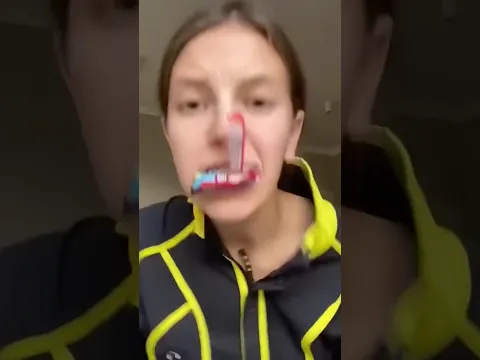 When You Don’t Know How To Use Braces!