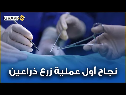 نجاح أول عملية زرع ذراعين وكتفين في العالم