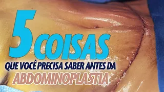 5 COISAS QUE VOCÊ PRECISA SABER ANTES DE FAZER ABDOMINOPLASTIA? CIRURGIA PLASTICA