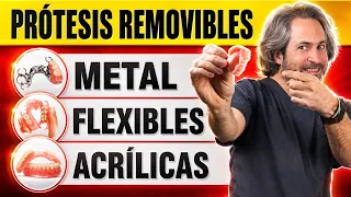 ✅ Tipos 𝗱𝗲 𝗣𝗥𝗢𝗧𝗘𝗦𝗜𝗦 𝗗𝗘𝗡𝗧𝗔𝗟𝗘𝗦 𝗥𝗘𝗠𝗢𝗩𝗜𝗕𝗟𝗘𝗦 : Ventajas e Inconvenientes ¿Que Dentadura Postiza es MEJOR?