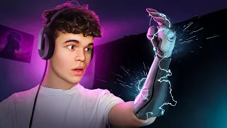 $50,000 Bionic Arm That Changed My Life!