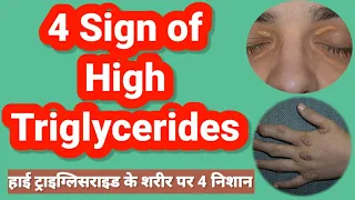 Sign of high triglycerides on body l हाई ट्राइग्लिसराइड के लक्षण l Hindi