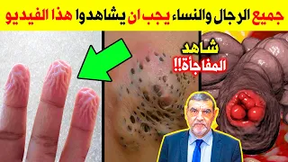 انتبه نأكله يوميا 🥫