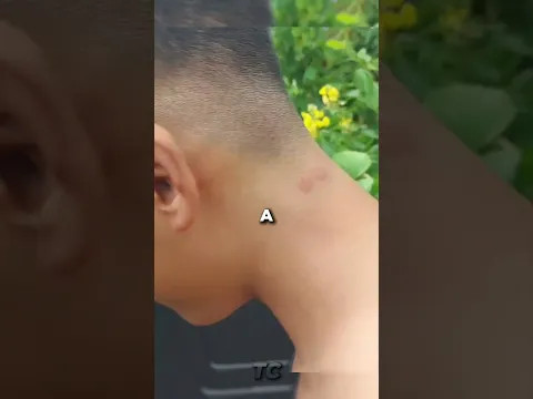 Paintball vs Airsoft – Which One Actually Hurts More? 💥😬