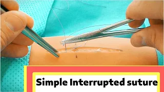 How to learn - Simple Interrupted suture surgery online part 10