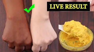 साबुन से नहीं इससे नहाएं, सालों साल जमी मैल कालापन शरीर से मिनटो मे साफ करे|body whitening remedy