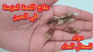 علاج الكحة نهائيا والسعال الحاد مهما كان قويا والنتائج من أول يوم قسما بالله مجربة وداعا للكحة طبيع