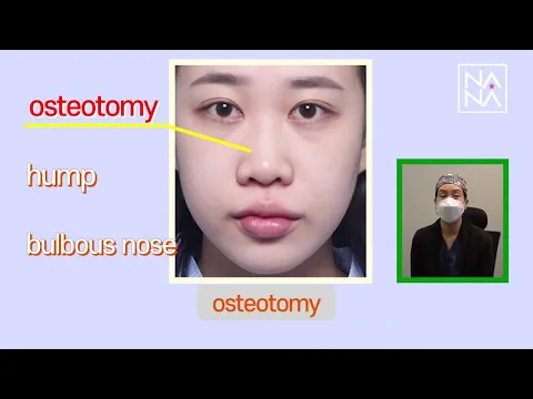 Сүт бездерінің арасындағы жас пенис