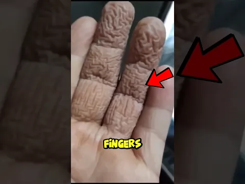 If Your Fingers Look Like This, Don’t Panic‼️😨