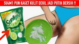 Baru Tahu!! Cara Ampuh Memutihkan  Kulit  Leher, Slang K4ngan Hitam, Gatal Berdaki