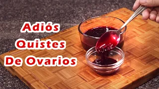 Bebe Esto y LOS QUISTES EN LOS OVARIOS DESAPARECEN - Tratamiento Natural Para Los Quistes Ováricos