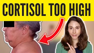 8 SIGNS OF HIGH CORTISOL *SKIN & HAIR* @DrDrayzday