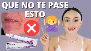 Lo que DEBES saber al INICIAR con TRETINOINA y tener ÉXITO ⭐ Método de 5 fases