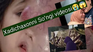 😢 Xadichaxon So'ngi videosi. Kasallik tarixidan so'ngi bekatgacha. Yigʻlamasdan koʻrolmaysiz! 