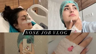 Nose job #vlog7  | ئێک ژ نەخوشترین روژێن من ددەمێ نشتەگەریێ دا بزانە بوچ ؟