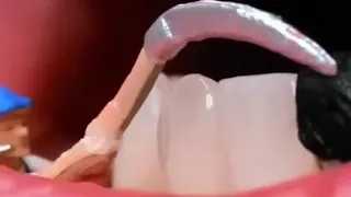 Tooth Disappears, Fruit Becomes a Tree, & Nails Turn Into Art!"Live