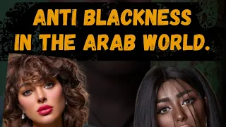 ANTI BLACKNESS IN THE ARAB WORLD. Did You Know?