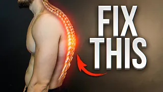 FIX THIS. BEFORE IT’S TOO LATE. Stop Rounded Posture