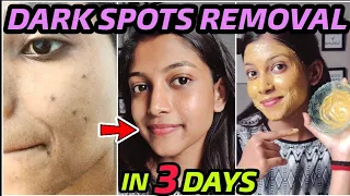 Remove DARK SPOTS NATURALLY in 3 Days 😍 Hyperpigmentation, Acne Scars, Brown Spots