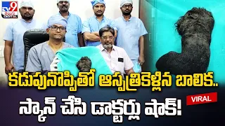 కడుపునొప్పితో ఆస్పత్రికెళ్లిన బాలిక.. స్కాన్ చేసి డాక్టర్లు షాక్!@TV9TeluguDigital