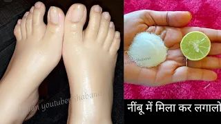 नींबू में बस ये चीज मिला कर लगालो रातो-रात हाथ पैर दूध जैसे गोरे और सॉफ्ट हो जाएंगे /100%effective