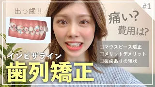 【歯列矯正①】痛い？費用は？大変？インビザラインで今感じるメリットデメリット｜抜歯ありマウスピース矯正🦷