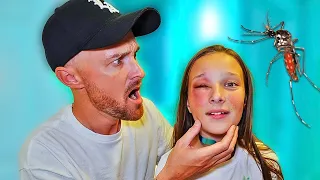 OLIVIA has an ALLERGIC REACTION on her FACE to BUG BITES!