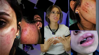 التعنيف التحرش التخدير و هروبي / الجزء الثالث