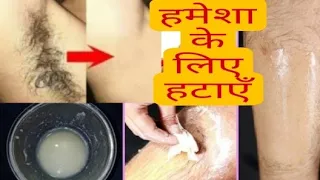 आधा चम्मच इस चीज से पूरे शरीर के अनचाहे बाल एक बार में हमेशा के लिए खत्म हो जाएंगे| Unwanted Hair ||