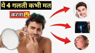 ये 4 ग़लती कभी मत करना | TOP PIMPLE MISTAKES | Habits That Remove Pimples from Face