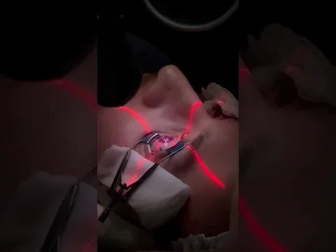 LEVEI UM SEGUIDOR PRA OPERAR OS OLHOS
