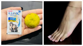 हाथ पैर धोते वक्त नींबू पे दो चीजे डाल लो सालों से जमी मैल मिण्टो में साफ़ होगा/Clean Feet Dirt &Tan