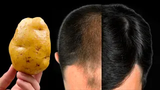 Haare wachsen wie verrückt und fallen nicht aus! Dies ist das mächtigste Werkzeug! Stärkste Zutat