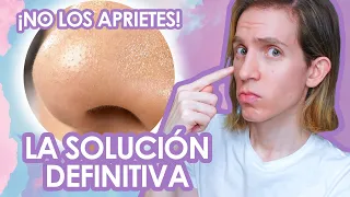 COMO ELIMINAR los FILAMENTOS SEBACEOS : Recomendaciones de un dermatologo