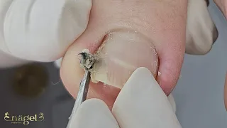 AQUILO ALI FAZIA DOER (Inacreditável)  #satisfying #viral