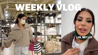 A lot of shopping vlog + lip filler dissolved ROUND 2