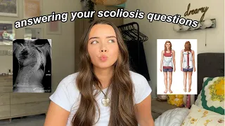 let’s talk about my body shape… and more scoliosis questions