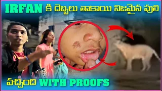 irfan కి దెబ్బలు తాకాయి నిజమైన పులి వచ్చింది | Pareshan Boys1