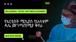 የአርቲስት ሚኪያስ ኤፍሬም የሁለቱም ዳሌ ሙሉ መገጣጠሚያ ቅየራ ባንዴ መከናወን እና የማገገም ሂደት በአዲስ አበባ፥ ኢትዮጵያ - ዶ/ር ሳሙኤል ኃይሉ