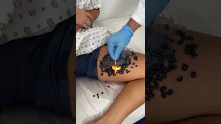 Gross discovery on her INNER THIGH😳
