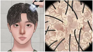 [ASMR] 보기만해도 시원한 대왕 두피각질 제거 애니메이션/Big Flakes Dandruff Scratching Animation