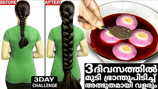 10രൂപയിൽ,3ദിവസത്തിൽ മുടി ഭ്രാന്തുപിടിച്ചു വളരും അത്ഭുതകരമായ രഹസ്യം!