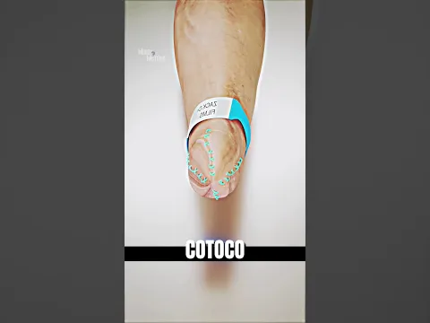 O que aconteceria se você perdesse a mão? #shorts
